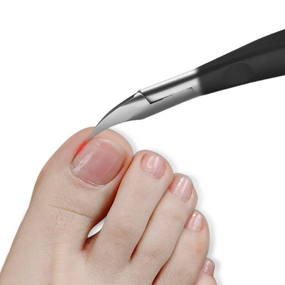 NailPro | Die ultimative Lösung für jedes Nagelproblem